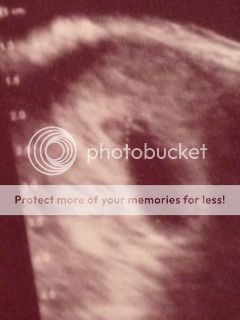 photo baby_zpsb1006571.jpg